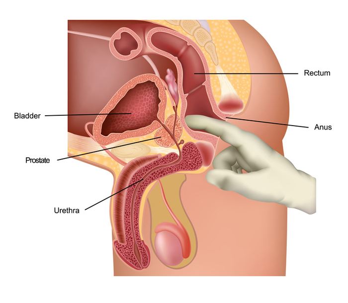 A prosztata masszázs befolyásolja az erekciót, Műtéti úton megnöveli a péniszét